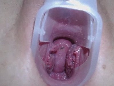 Young girl exploring cervix & deep pussy with speculum